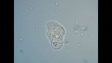 Amoebas under the microscope - 1000x magnification