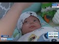 Рома Еремеев, 4 месяца, врожденная двусторонняя косолапость, спасет лечение по методу Понсети