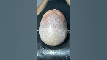 Xăm chân tóc hói