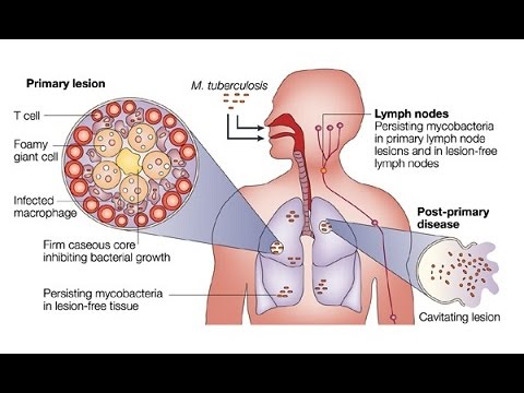 The visa medical - what the doctors and nurses say