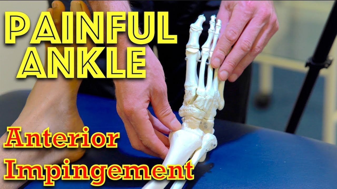 Ankle Pain Anterior Impingement Dr Gill YouTube Ankle pain anterior impingement dr gill youtube