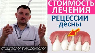 Сколько стоит лечение рецессии десны. Причины опущения десны