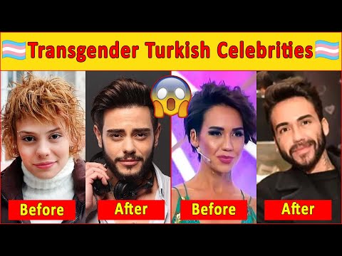 The Incredible Life story of Transgender Turkish Celebs😱Turkish Drama|Turkish Series|Turkish Actor