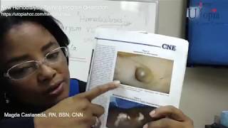 Aneurysm vs pseudoaneurysm [CHT CERTIFICATION REVIEW] 2022 by Utopia HCC 32,431 views 6 years ago 12 minutes, 32 seconds