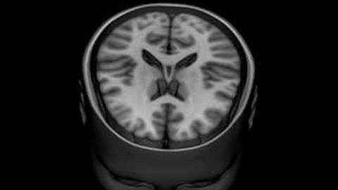 MRI brain volume render