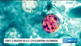 Michigan reports first two deaths in US behind cyclospora outbreak