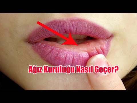 Ağız Kuruluğu Nasıl