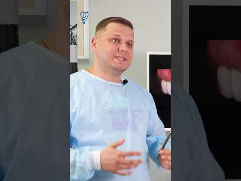 Что мы увидели в полости рта пациента. Имплантация зубов.