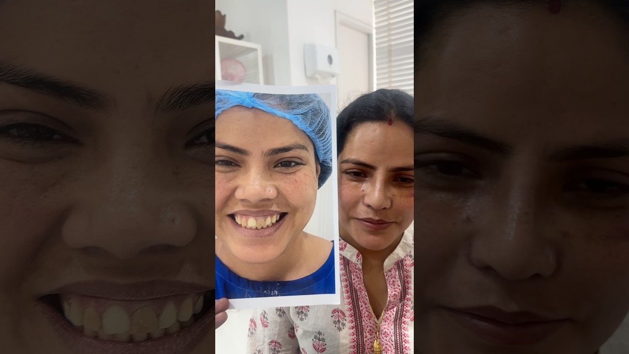 Best Chin, Nose, Cheeks, Lip Cosmetic Plastic Surgery – Facemakeover @ Richardsons