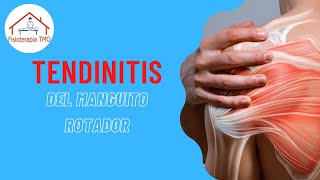 Tendinitis del Manguito Rotador - Fisioterapia