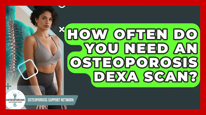 How Often Do You Need An Osteoporosis DEXA Scan? - Osteoporosis Support Network