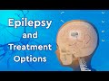 What is epilepsy and how is it treated