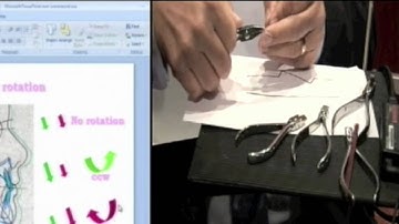 Second Order Wire Bending