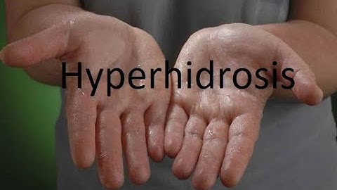 Gacmo dhididka badan(Hyperhidrosis) maxaa keena ?