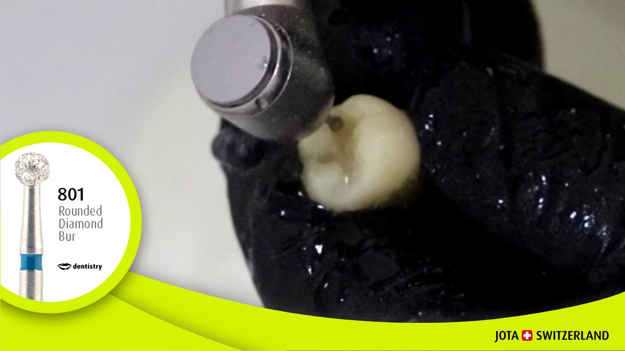 Dental Diamond Bur 801 (rounded shape) - Preparation Procedure / JOTA