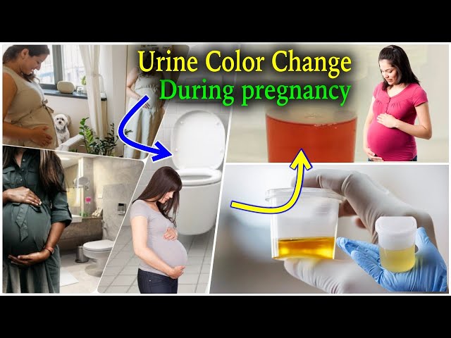 Can Early Pregnancy Affect Urine Color?