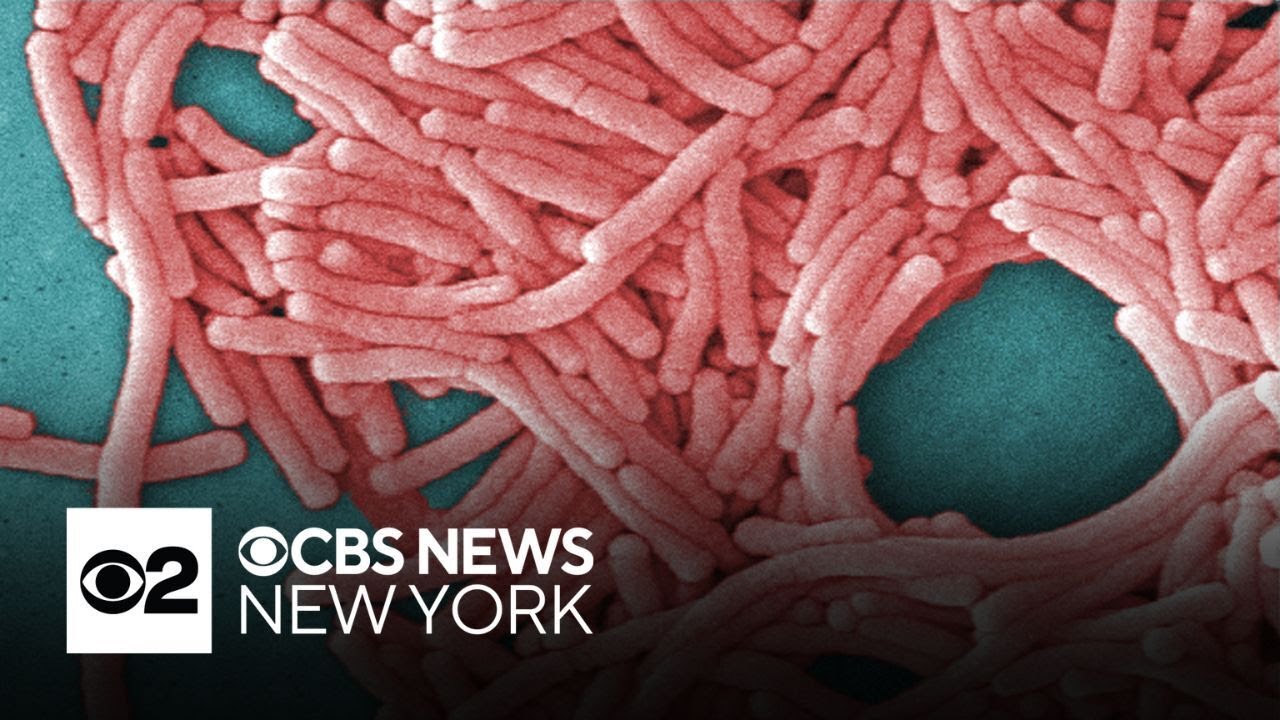 Legionella found in water at St. Joseph's University Medical Center in Paterson, N.J.