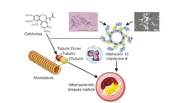 Comment agit la colchicine dans la goutte ?