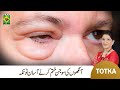 Zubaida Apa Totka Ankhon Ki Sujan Ka Ilaj Puffiness In Eyes Quick Home Remedy MasalaTv Zubaida Apa Totka Ankhon Ki Sujan Ka Ilaj Puffiness In Eyes Quick Home Remedy MasalaTv