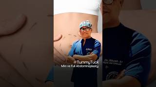 Mini vs Full Tummy Tuck Explained ✨ Which One Is Right? | Dr. Ritesh Anand Explains