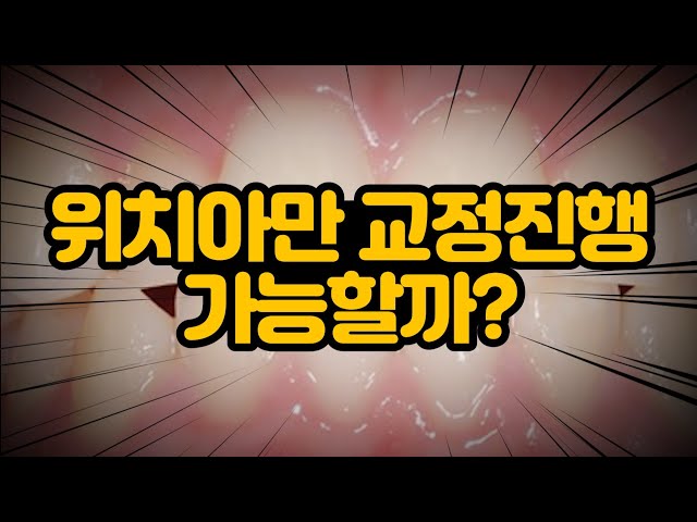 위치아만 교정진행 가능한가요?