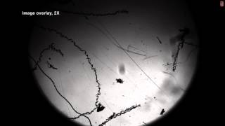 Prakash Lab Entry For Aps Dfd 2014 Cercariae Schistosomiasis Swimming Mechanics