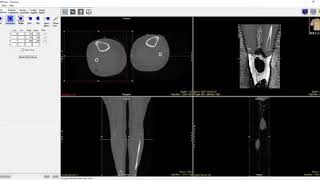 Analyze 14.0 - Transform Cropping Data Using Subregion