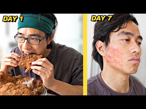 I Ate Foods that "GUARANTEE" ACNE for 7 Days STRAIGHT
