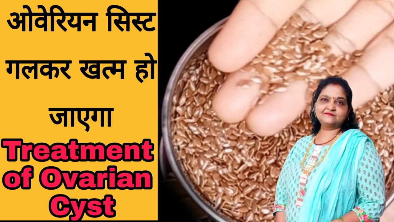 सिस्ट का इलाज Cyst Ka Ilaaj!ओवेरियन सिस्ट का इलाज Treatment of Ovarian Cyst in Hindi YouTube