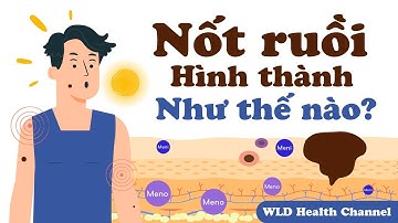 Nốt ruồi hình thành như thế nào?