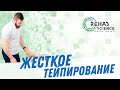 Жесткое тейпирование, по концепции маллиган. Mulligan Concept