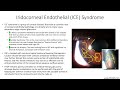 Lecture: Iridocorneal Endothelial (ICE) Syndrome (1 Slide in 5 Minutes)