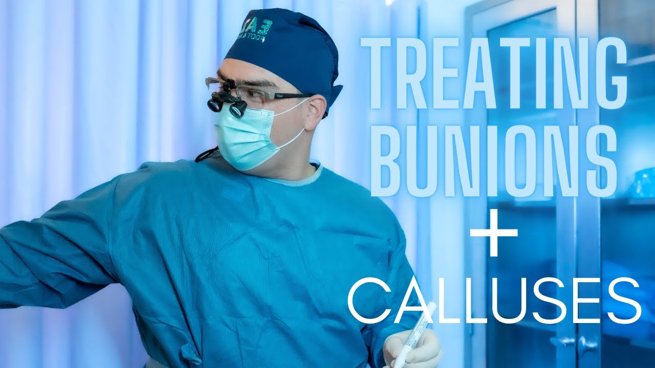 Treating Bunions & Callus | Dr. Elhiani | Eazy Foot & Ankle | Beverly Hills