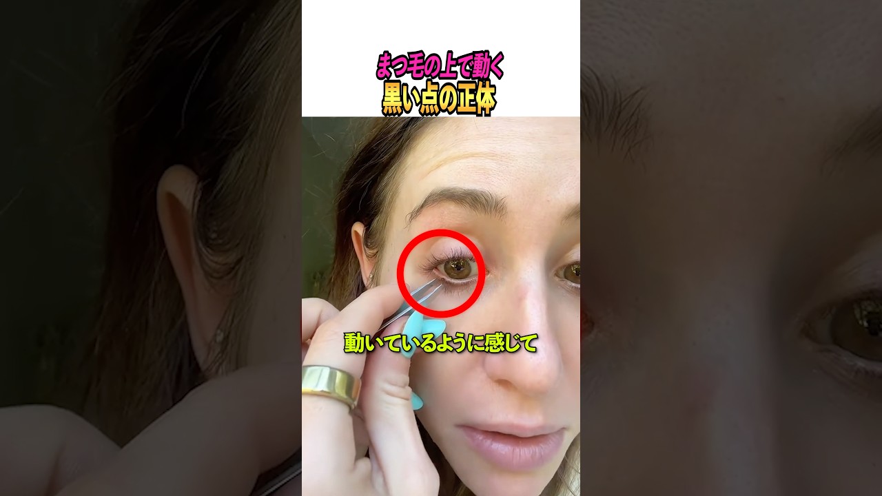 まつ毛の上で動く黒い点の正体