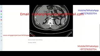 Kidney Stone Identification Using Image Processing Python Project With Source Code Kidney Stone