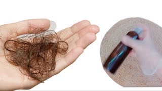 وصفة القرنفل لتطويل ولمعان الشعر مضمونة 100%