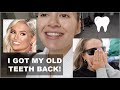 MY TEETH TRANSFORMATION... STRIPPING IT BACK! VLOG | MOLLYMAE