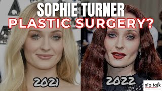 Sophie Turner Plastic Surgery Did She Get Buccal Fat Removal