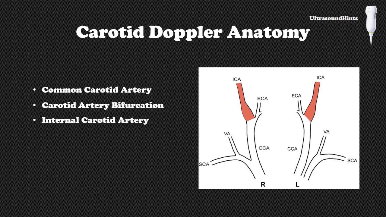 carotid doppler ultrasound cpt code carotid doppler ultrasound cpt code