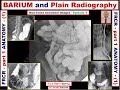 FRCR - part 1 (Anatomy) Episode-1 BARIUM and abdominal radiograph studies.