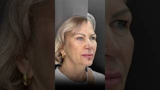 Открыть» верхнюю часть лица: приобрести молодой взгляд.