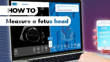 InSimo & AGOF - #howto measure a fetus head in diSplay U/S simulator