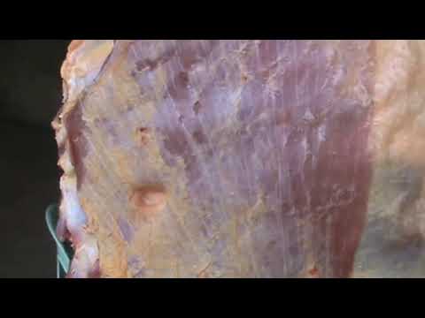 4th EPIC muscle spasms compilation...without skin (twitching meat edition)