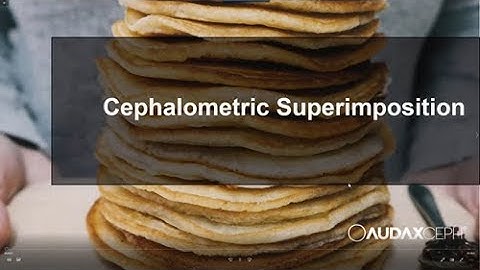 AudaxCeph - Superimpositions