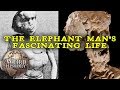 The Elephant Man | The Weird & Tragic Story of Joseph Merrick