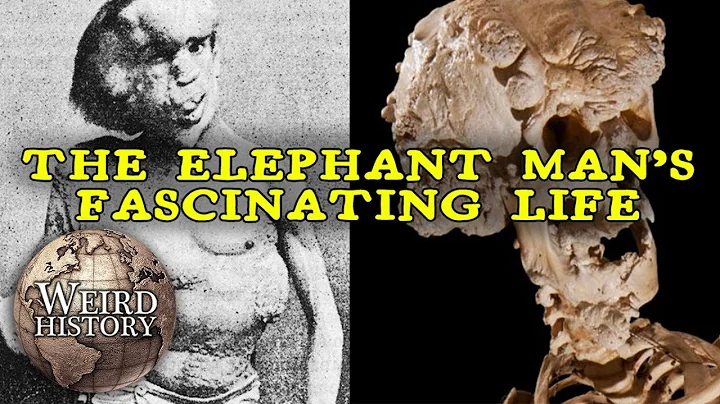 The Elephant Man | The Weird & Tragic Story of Jos...