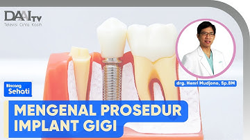 Mengenal Prosedur Implan Gigi | Bincang Sehati