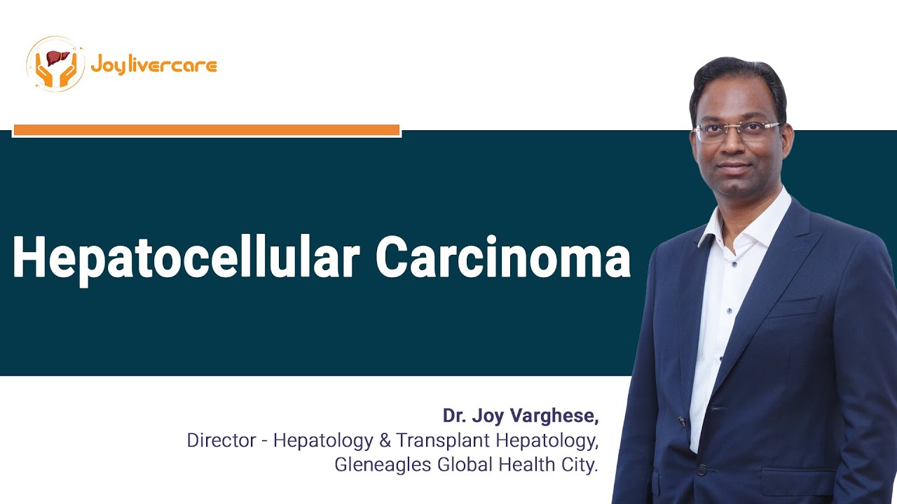 hepatocellular-carcinoma-best-explained-by-dr-joy-varghese-liver
