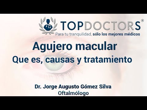 Agujero macular: Qué es, causas y tratamiento