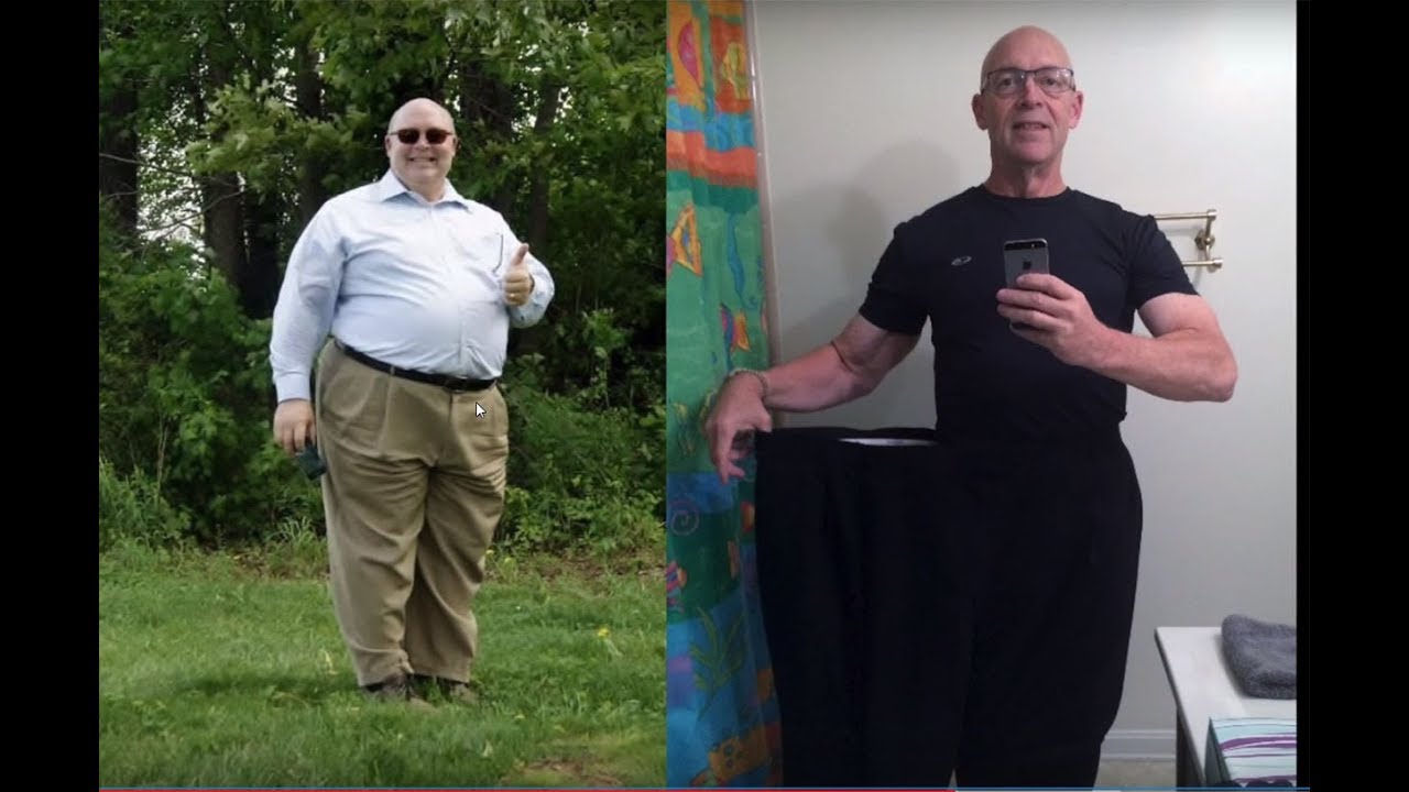 Inova Weight Loss Services Craig's Story YouTube